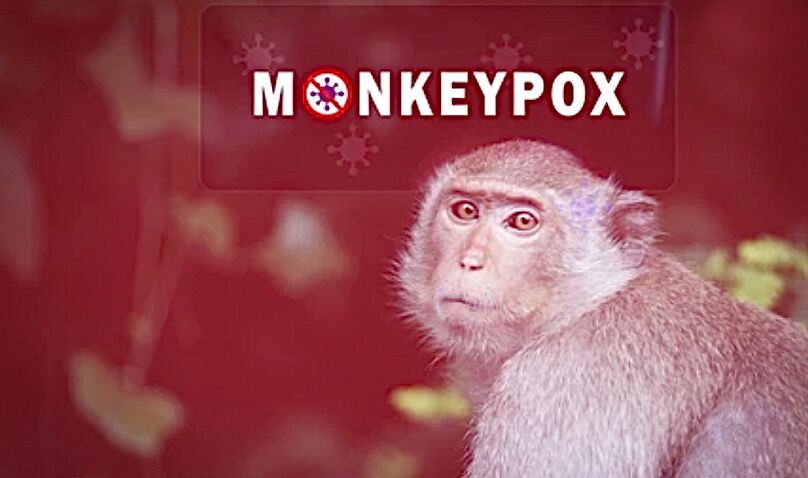 Monkeypox Virus